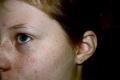 Millised maskid aitavad freckles: retseptid
