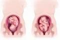 Præsentation af embryonet.  Spørgsmål.  Skrå eller tværgående præsentation